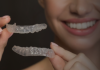 Ортодонтия для взрослых: возможно ли исправление прикуса без брекетов